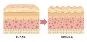 加齢